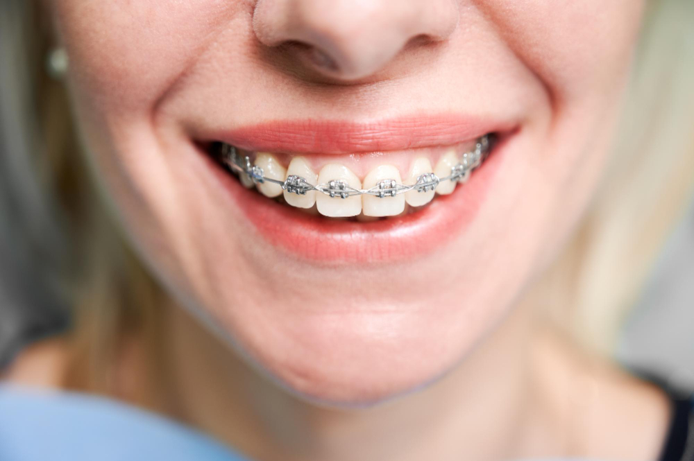 orthodontic services  Norway, ME