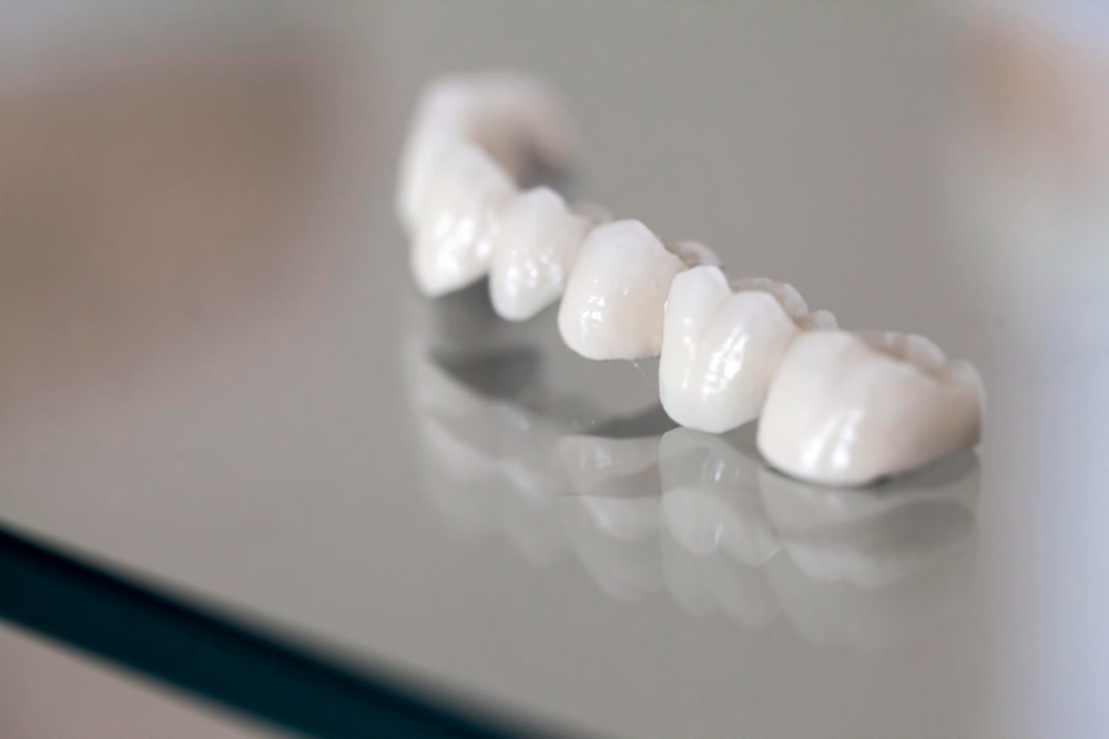Porcelain Crowns in Norway